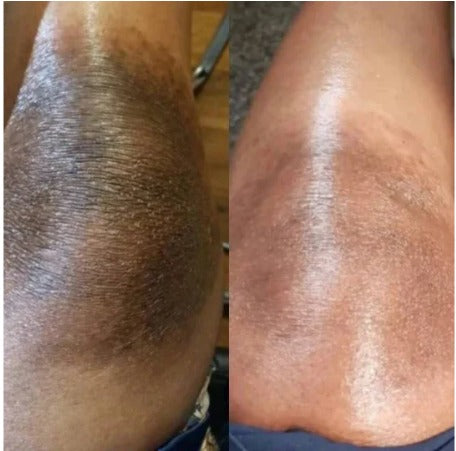 Skin Shedding Lotion