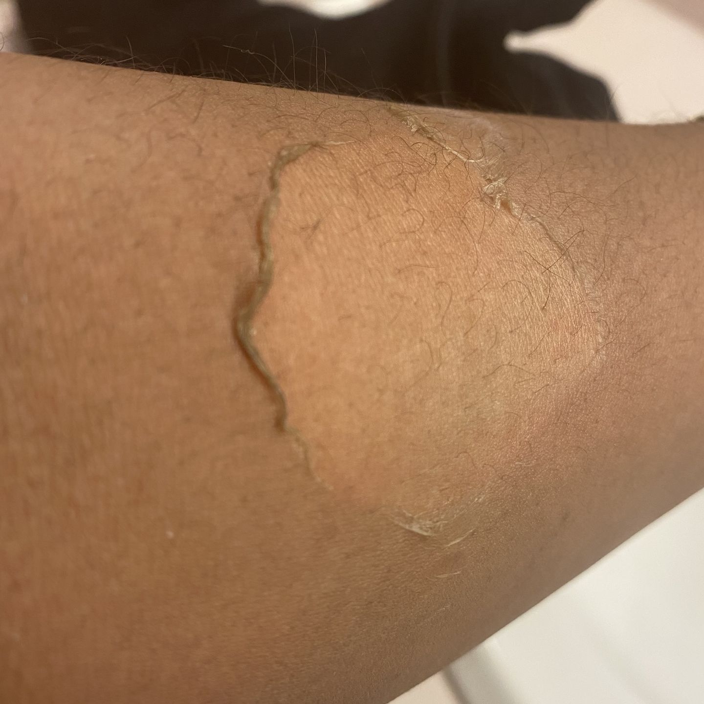 Skin Shedding Lotion